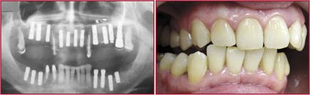 Aparat foto digital ca instrument de lucru al dentistului