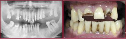 Aparat foto digital ca instrument de lucru al dentistului