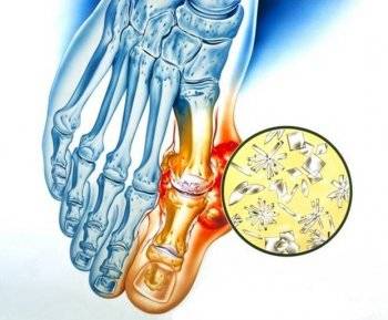 Які існують хвороби ніг, їх симптоми, причини і лікування