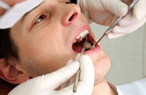 Chist pe rădăcina tratamentului dintelui și alegerea metodei