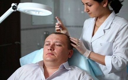 A kezelés a férfi kopaszság, mezoterápia haj - véleménye, fotók, portál esztétika