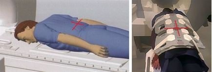 MRI a vékonybél ( „tartsa vissza a lélegzetét belégzés”) MRI a vékonybél