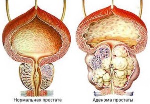 Отруєння аконітом, небезпека отруєння отруйними рослинами, симптоми і лікування