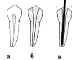 Skye - endodonția clinică