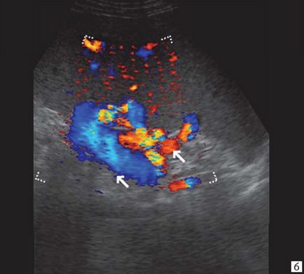 Ultrahang diagnosztika elzáródásos sárgaság - a kurzantseva