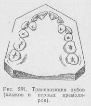 Anomalii ale dinților individuali, stomatologie ortopedică