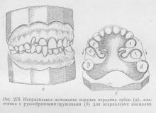 Аномалії положення окремих зубів, ортопедична стоматологія