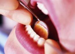 Cum să tratați boala gingiilor după extracția dinților