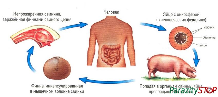 Ce este vierme de porc periculos și cum să scapi de ea