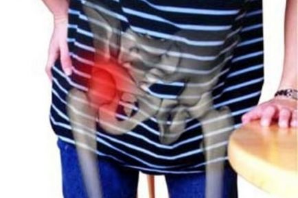 Deformáló csípő osteoarthritis tünetei, okai és kezelése