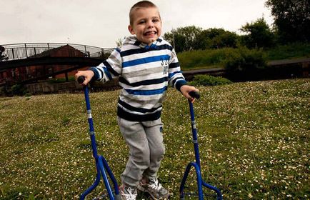 Paralizie cerebrală pentru copii - viața normală este posibilă!