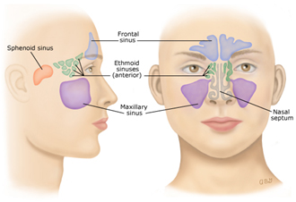 Sinuzita la copii simptome, diagnostic, tratament