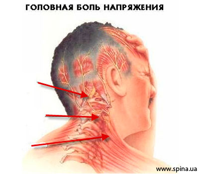Головні болі, чому болить голова, позбутися від головних болів, лікування головного болю, crb clinic