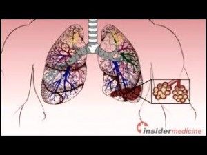 Hormonterápia pneumonia kezelésére gyermekeknél a gyógyszer