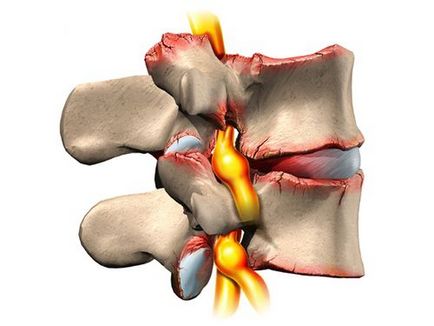 Грижа на рентгені хребта чи можна побачити і як описується