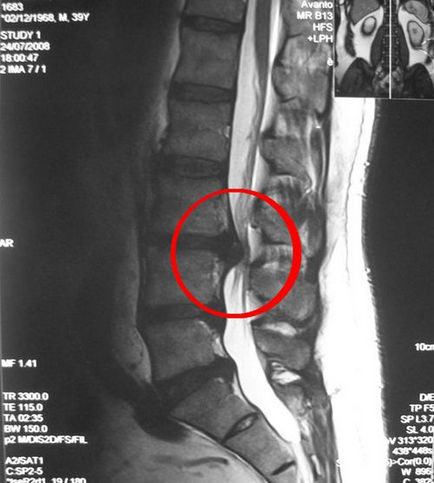 Грижа на рентгені хребта чи можна побачити і як описується