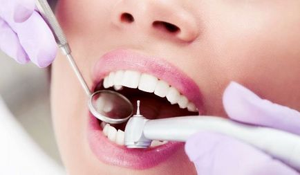 Cum să tratați cariile dentare nu este deloc înfricoșător!