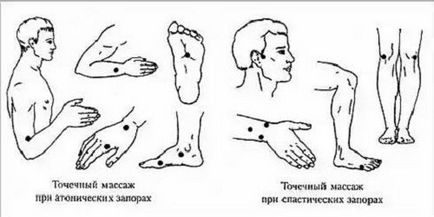 Як налагодити роботу кишечника при запорах, захворювання, лікування, дієта