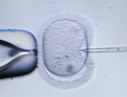 Cum să găsiți donatorul ideal de spermatozoizi pentru conceperea copilului