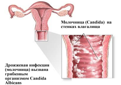 Cum sunt transmise căile de transmitere a infecțiilor posibile