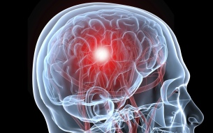 Cum de a recunoaște un accident vascular cerebral