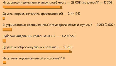 Як втекти від інсульту, діагноз, офіційний сайт газети медичний вісник