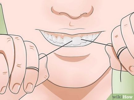 Cum de a reduce boala gingiilor