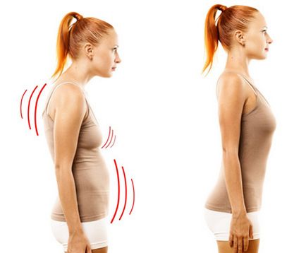 Cum să vă îndreptați spatele - corsete ortopedice pentru coloana vertebrală
