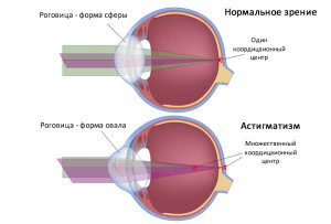 Краплі знімуть пелену з очей