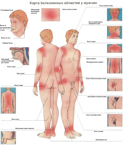 Carduri de diagnoză primare