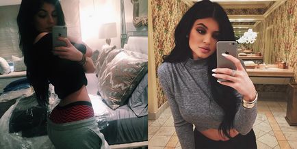 Kylie Jenner előtt és után plasztikai sebészet - 300