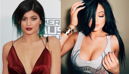 Kylie Jenner előtt és után plasztikai sebészet - 300