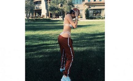 Kylie Jenner előtt és után plasztikai sebészet - 300