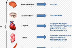 Класифікація артеріальної гіпертензії