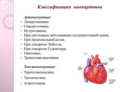 Osztályozása myocarditis - A WHO szerint, az áramlás, patológiai anatómia (downstream) Osztályozása szívizomgyulladás - A WHO szerint, az árral, kórbonctan