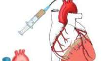 Terapia celulară a infarctului miocardic deja în Rusia