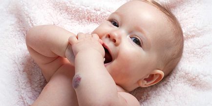 Лазерне лікування гемангіоми у новонароджених