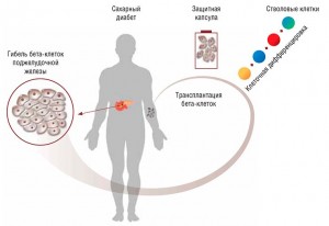 Tratamentul diabetului zaharat în China