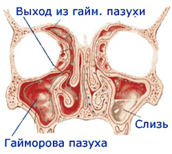 Tratamentul sinuzitei - sfatul medicului - catalogul articolelor