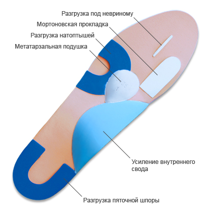 Трохи інформації про ортопедичні устілки