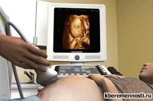 Miért baj ultrahang meghatározásánál a gyermek neme, meghatározása a gyermek neme