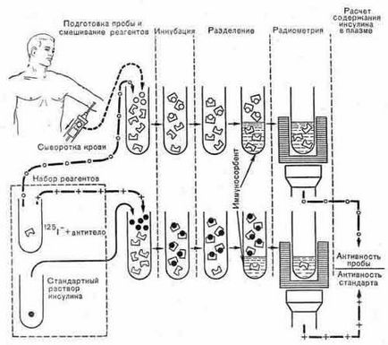 Studiul cu radionuclizi a studiilor de pancreas - radionuclizii în endocrinologie -