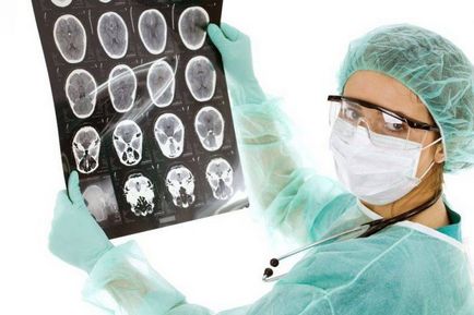 Simptomele și semnele de cancer la creier în stadiile incipiente
