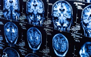 Simptome și semne de cancer la creier în stadiile incipiente