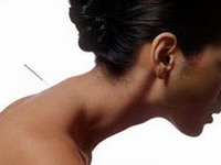 Reflexoterapie (acupunctura, acupunctura)