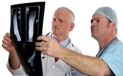 Raza radiologică a călcâiului (osul călcâiței) al bolțului, descrierea, tratamentul