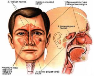 Риносинусит що це таке, причини, симптоми