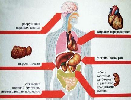 Piroză severă după alcool provoacă, cum să scapi