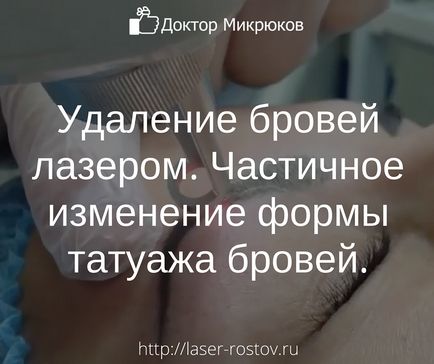 Тъмно петно ​​след отстраняване на родилни петна