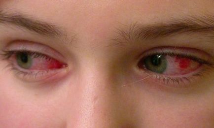 Дізнайтеся причини болю в очах